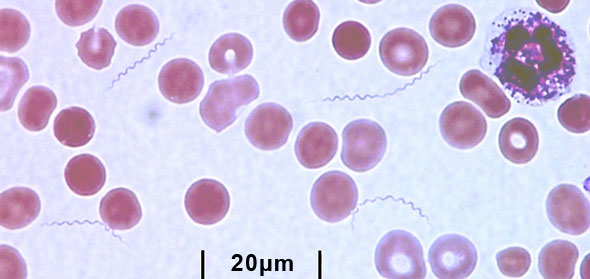 tbrf-smear.jpg