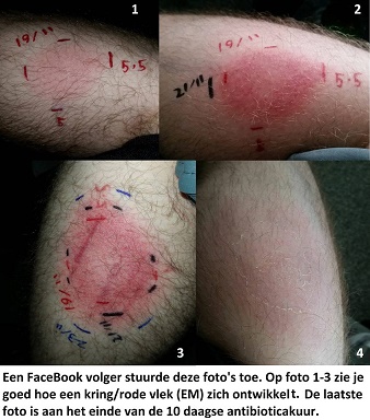 EM rode kring-vlek.jpg